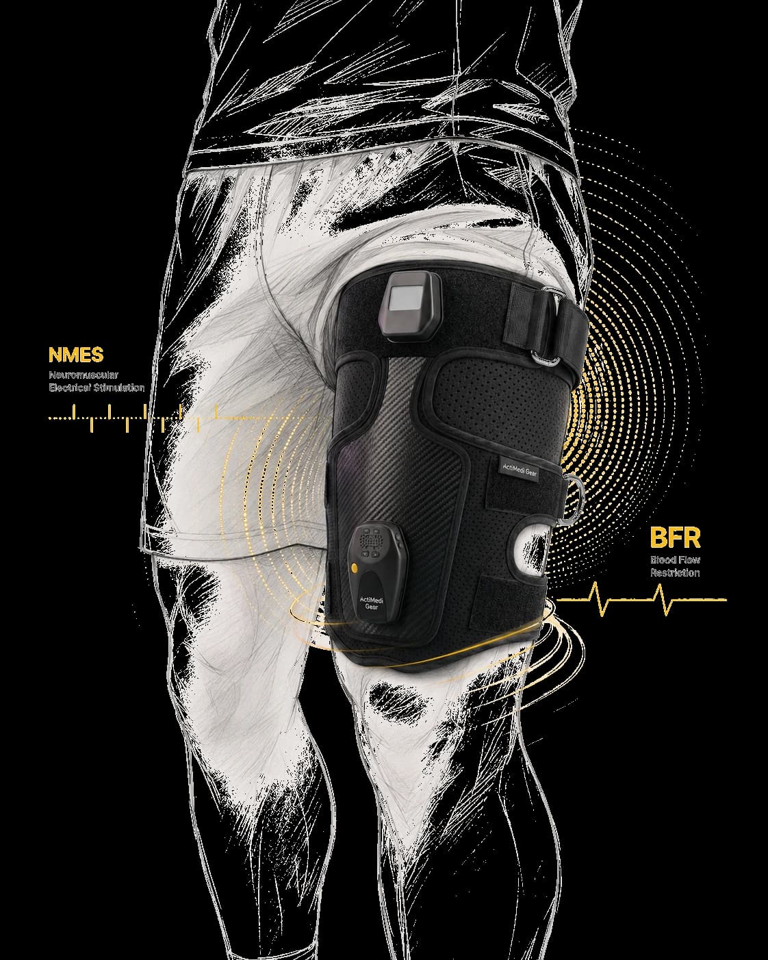 ActiMedi Gear — 무릎 재활 웨어러블 장착 사진